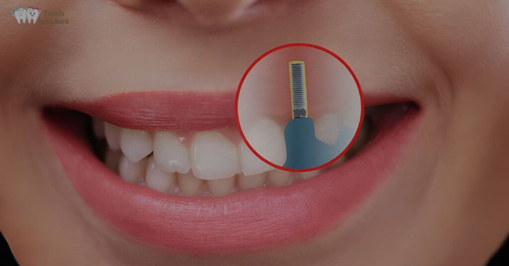 Can Dental Implants Restore Face Shape? Complete Guidance