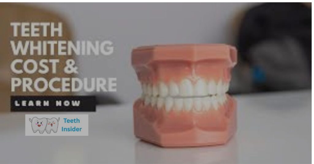 How Much Does Teeth Whitening Cost in California?