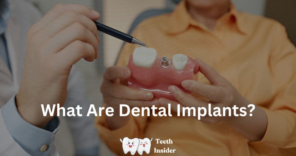 What Are Dental Implants? Types, procedures, and more