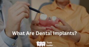 What Are Dental Implants? Types, procedures, and more