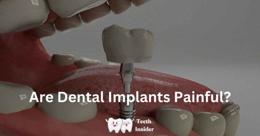Are Dental Implants Painful? A Comprehensive Guide