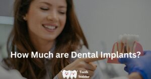 How Much are Dental Implants? Complete Guide