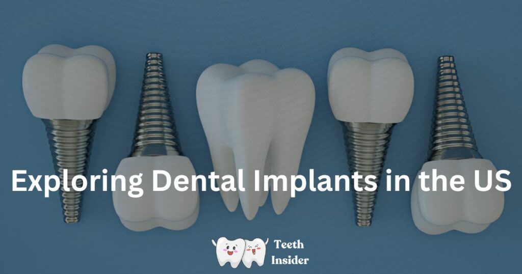 Exploring Dental Implants in the US
